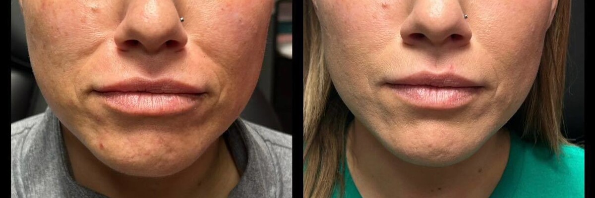 Aesthetic Unfiltered Aurora & Ocelli Aesthetics Terre Haute