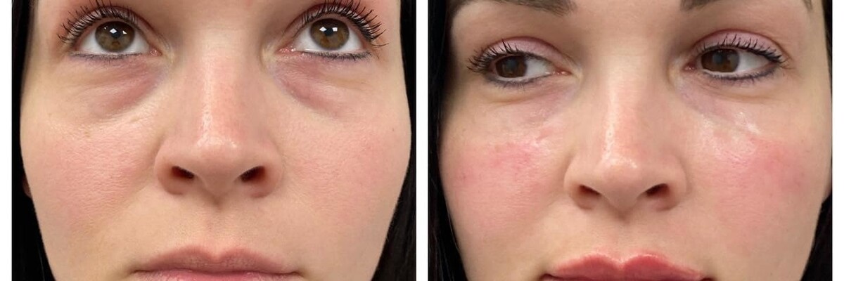 Aesthetic Unfiltered Aurora & Ocelli Aesthetics Terre Haute