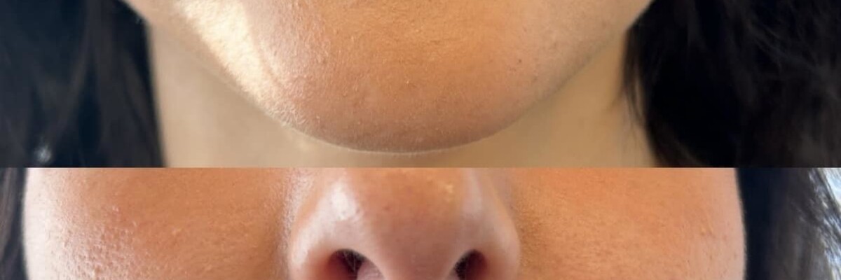 Aesthetic Unfiltered Aurora & Ocelli Aesthetics Terre Haute