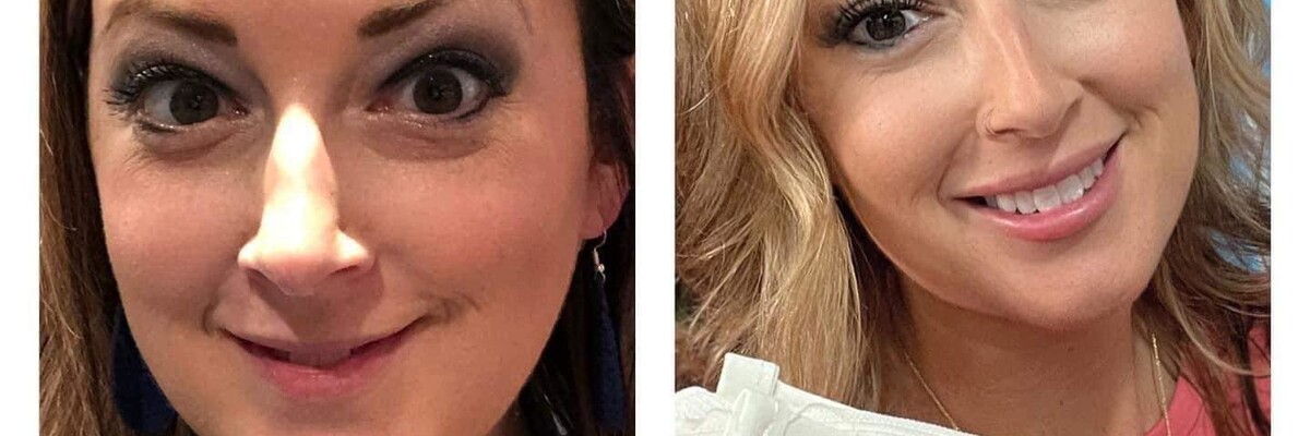 Aesthetic Unfiltered Aurora & Ocelli Aesthetics Terre Haute