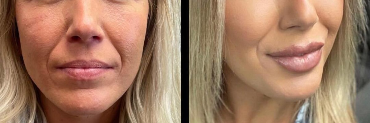 Aesthetic Unfiltered Aurora & Ocelli Aesthetics Terre Haute