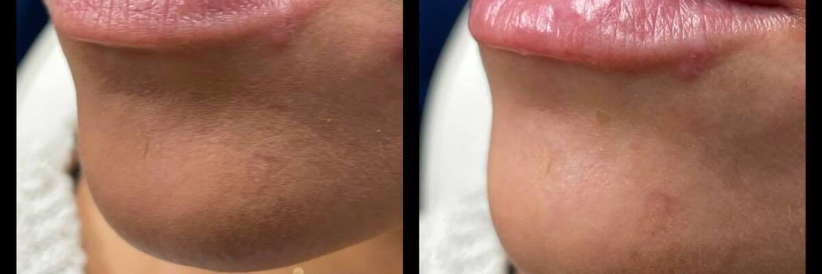 Aesthetic Unfiltered Aurora & Ocelli Aesthetics Terre Haute