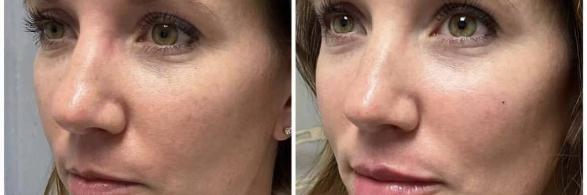 Aesthetic Unfiltered Aurora & Ocelli Aesthetics Terre Haute